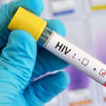 Mais de 300 pessoas foram infectadas com HIV em 2023; Estado recebe novo medicamento