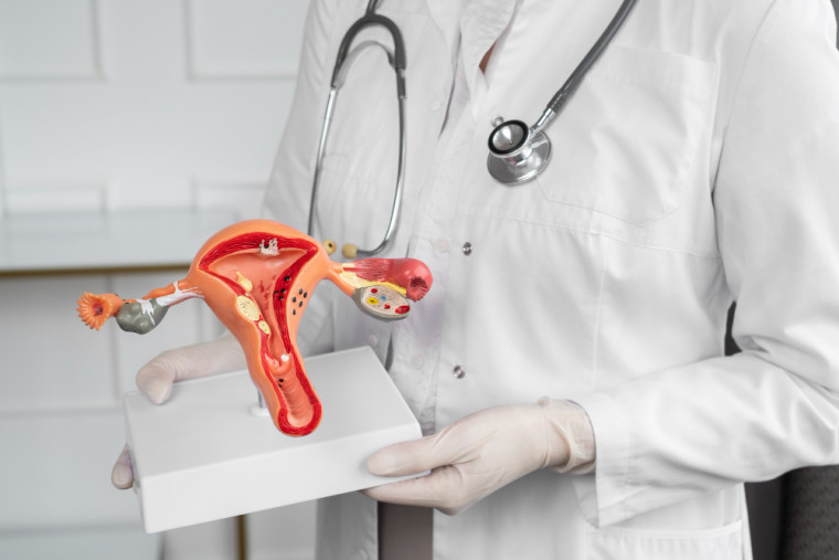 Adenomiose: sintomas, causas e tratamentos para aliviar a dor e o sangramento abundante