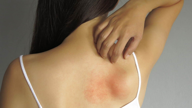 Carteira de Fibromialgia já pode ser emitida no Portal de Serviços do Governo do Estado